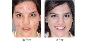 Skin Care