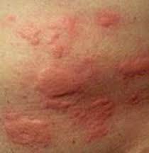 Allergies & Sensitive Skin 1