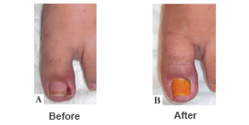 Nail Care