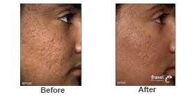 Scars 2
