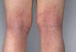 Allergies & Sensitive Skin 2